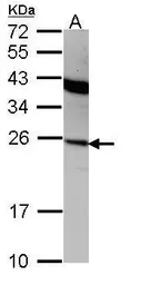 Anti-interferon alpha 2 antibody [C1C3] used in Western Blot (WB). GTX108284