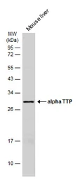Anti-alpha TTP antibody [C2C3], C-term used in Western Blot (WB). GTX108286