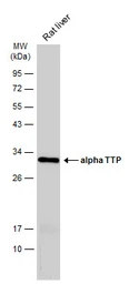 Anti-alpha TTP antibody [C2C3], C-term used in Western Blot (WB). GTX108286