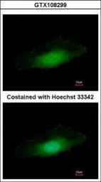 Anti-PPP4C antibody [N1], N-term used in Immunocytochemistry/ Immunofluorescence (ICC/IF). GTX108299