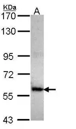 Anti-COL4A3BP antibody [N1], N-term used in Western Blot (WB). GTX108303