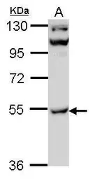 Anti-CaMKII gamma antibody [N1], N-term used in Western Blot (WB). GTX108304