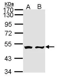 Anti-AKD1 antibody [N1], N-term used in Western Blot (WB). GTX108308