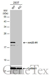 Anti-nm23-H1 antibody [C1C3] used in Western Blot (WB). GTX108325