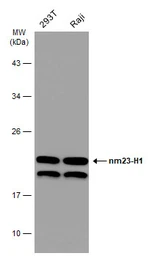 Anti-nm23-H1 antibody [C1C3] used in Western Blot (WB). GTX108325