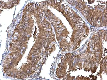 Anti-nm23-H1 antibody [C1C3] used in IHC (Paraffin sections) (IHC-P). GTX108325
