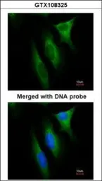 Anti-nm23-H1 antibody [C1C3] used in Immunocytochemistry/ Immunofluorescence (ICC/IF). GTX108325