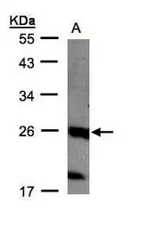 Anti-C1orf57 antibody [C2C3], C-term used in Western Blot (WB). GTX108326