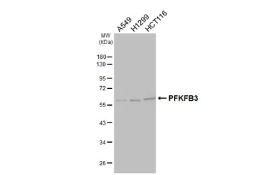 Anti-PFKFB3 antibody [C3], C-term used in Western Blot (WB). GTX108335