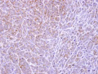 Anti-COL4A3BP antibody [C3], C-term used in IHC (Paraffin sections) (IHC-P). GTX108337