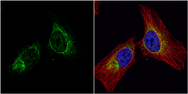 Anti-IFIT2 antibody [N1], N-term used in Immunocytochemistry/ Immunofluorescence (ICC/IF). GTX108346