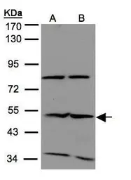 Anti-IFIT2 antibody [N1], N-term used in Western Blot (WB). GTX108346