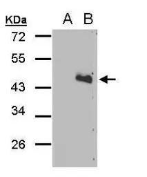 Anti-DRICH1 antibody [C2C3], C-term used in Western Blot (WB). GTX108358