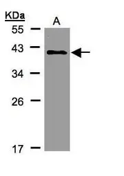 Anti-KLHDC8A antibody [C2C3], C-term used in Western Blot (WB). GTX108361