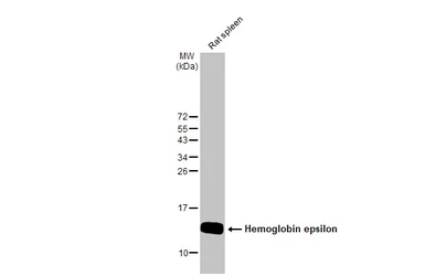 Anti-Hemoglobin epsilon antibody [N1N2], N-term used in Western Blot (WB). GTX108396