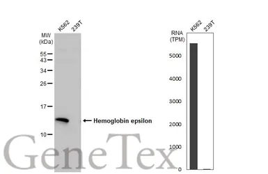 Anti-Hemoglobin epsilon antibody [N1N2], N-term used in Western Blot (WB). GTX108396