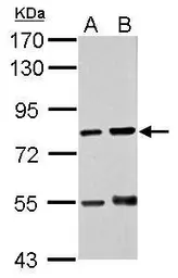 Anti-RED antibody [N1], N-term used in Western Blot (WB). GTX108398