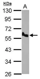 Anti-BMP10 antibody [C3], C-term used in Western Blot (WB). GTX108409