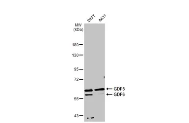 Anti-GDF5 + GDF6 antibody [C3], C-term used in Western Blot (WB). GTX108415