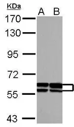 Anti-GDF5 + GDF6 antibody [C3], C-term used in Western Blot (WB). GTX108415