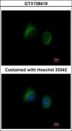 Anti-IL1F7 antibody [C2C3], C-term used in Immunocytochemistry/ Immunofluorescence (ICC/IF). GTX108419