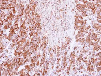 Anti-IL1F7 antibody [C2C3], C-term used in IHC (Paraffin sections) (IHC-P). GTX108419