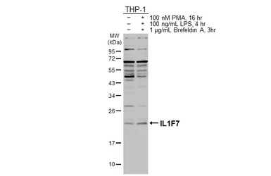 Anti-IL1F7 antibody [C2C3], C-term used in Western Blot (WB). GTX108419
