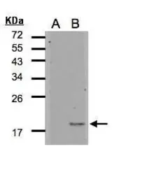 Anti-IL1F5 antibody [C1C3] used in Western Blot (WB). GTX108421