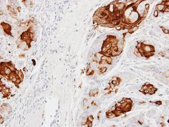 Anti-CCL28 antibody [N3C3] used in IHC (Paraffin sections) (IHC-P). GTX108432