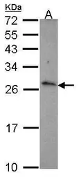 Anti-CD70 antibody [C2C3], C-term used in Western Blot (WB). GTX108452