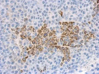 Anti-IL1F9 antibody [C1C3] used in IHC (Paraffin sections) (IHC-P). GTX108466