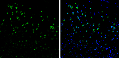 Anti-Syntenin 1 antibody [C2C3], C-term used in IHC (Frozen sections) (IHC-Fr). GTX108470