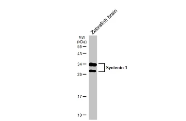 Anti-Syntenin 1 antibody [C2C3], C-term used in Western Blot (WB). GTX108470