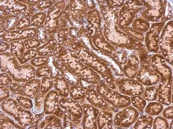 Anti-Syntenin 1 antibody [C2C3], C-term used in IHC (Paraffin sections) (IHC-P). GTX108470