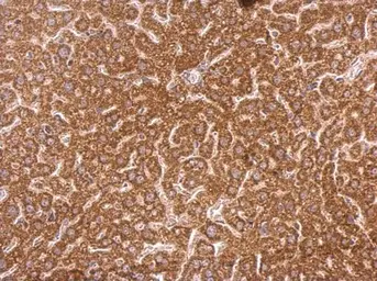 Anti-Syntenin 1 antibody [C2C3], C-term used in IHC (Paraffin sections) (IHC-P). GTX108470