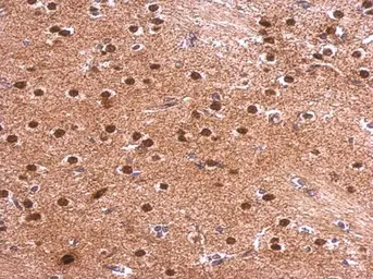 Anti-Syntenin 1 antibody [C2C3], C-term used in IHC (Paraffin sections) (IHC-P). GTX108470