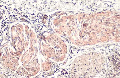 Anti-BCA1 antibody [N3C3] used in IHC (Paraffin sections) (IHC-P). GTX108471