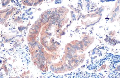 Anti-BCA1 antibody [N3C3] used in IHC (Paraffin sections) (IHC-P). GTX108471