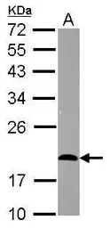 Anti-CD3 epsilon antibody [C2C3], C-term used in Western Blot (WB). GTX108478