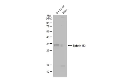 Anti-Ephrin B3 antibody [C2C3], C-term used in Western Blot (WB). GTX108485