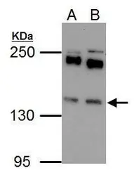 Anti-Eps15 antibody [C3], C-term used in Western Blot (WB). GTX108486