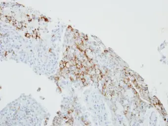 Anti-FCER1G antibody [N2C3] used in IHC (Paraffin sections) (IHC-P). GTX108487