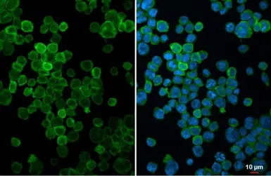Anti-FCER1G antibody [N2C3] used in Immunocytochemistry/ Immunofluorescence (ICC/IF). GTX108487