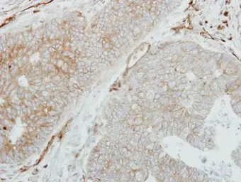 Anti-HLA-DMB antibody [C2C3], C-term used in IHC (Paraffin sections) (IHC-P). GTX108492