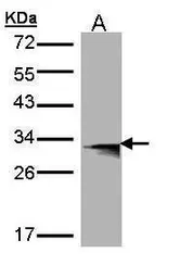 Anti-HLA-DMB antibody [C2C3], C-term used in Western Blot (WB). GTX108492