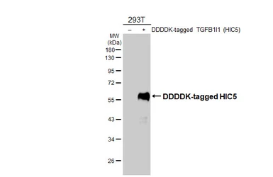 Anti-HIC5 antibody [N1], N-term used in Western Blot (WB). GTX108510