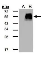 Anti-HIC5 antibody [N1], N-term used in Western Blot (WB). GTX108510