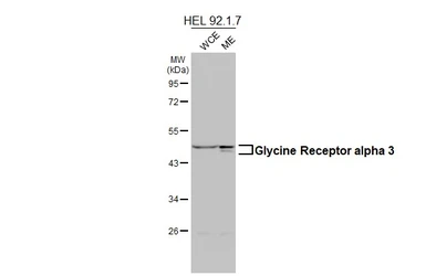 Anti-Glycine Receptor alpha 3 antibody used in Western Blot (WB). GTX108513
