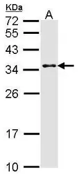 Anti-CRSP9 antibody [C2C3], C-term used in Western Blot (WB). GTX108522