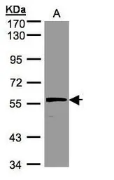 Anti-Noelin antibody [C3], C-term used in Western Blot (WB). GTX108528